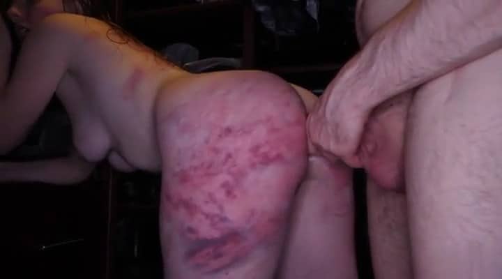 Submissive Bruised Slut Being Anally Destroyed by Her Man