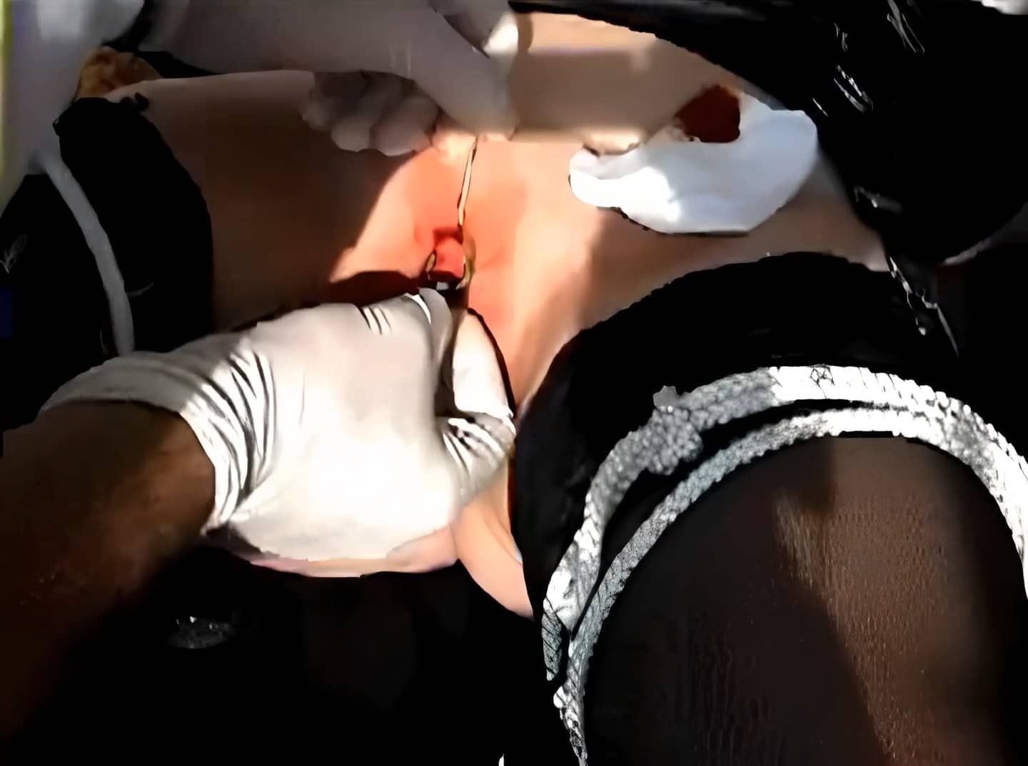 Mature Slave Slut Endure Extreme Clit Piercing